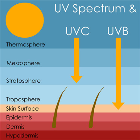 What is UVB?